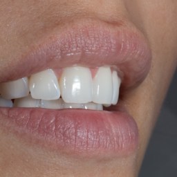 How much do you show?